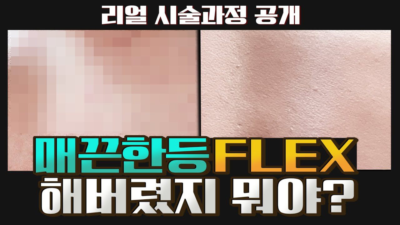 몸드름 부자 탈출하는법? 이거 하나면 탈출 쌉가능! 썸네일