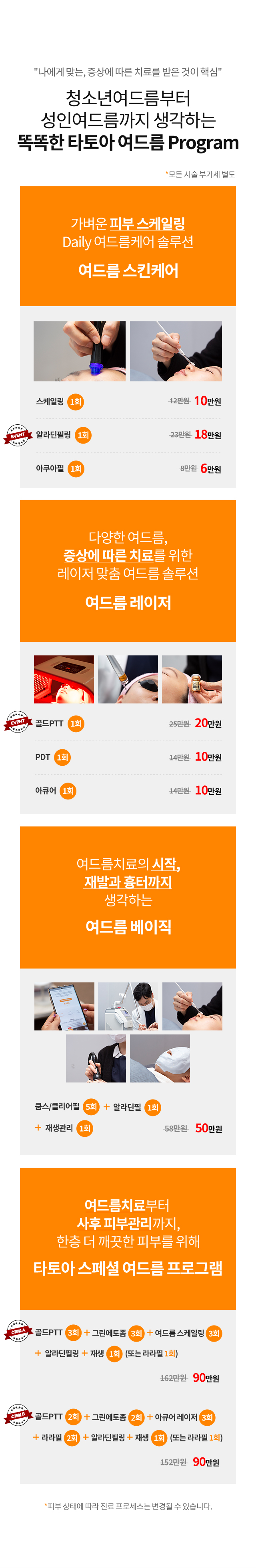 여드름치료