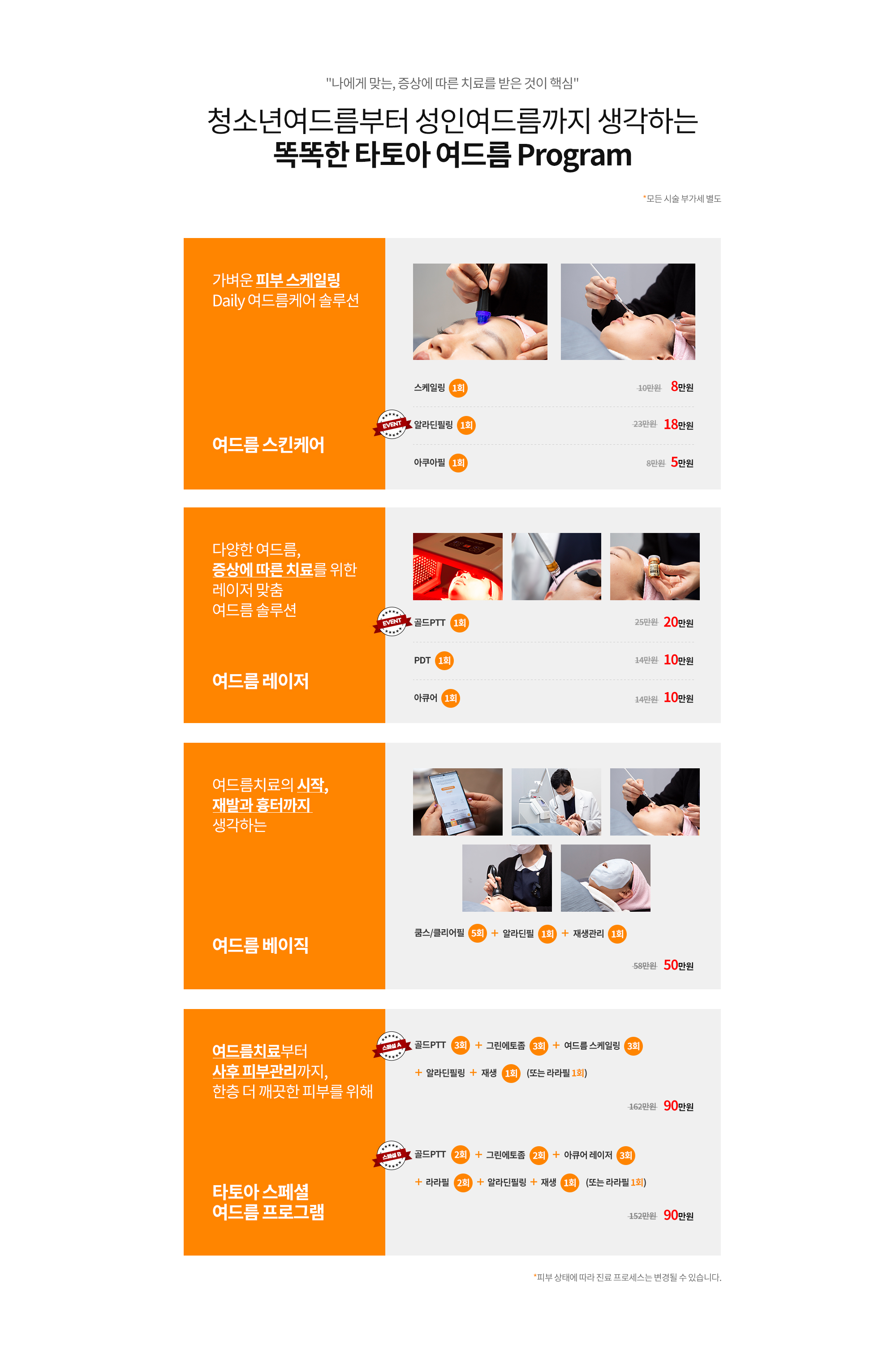 여드름치료