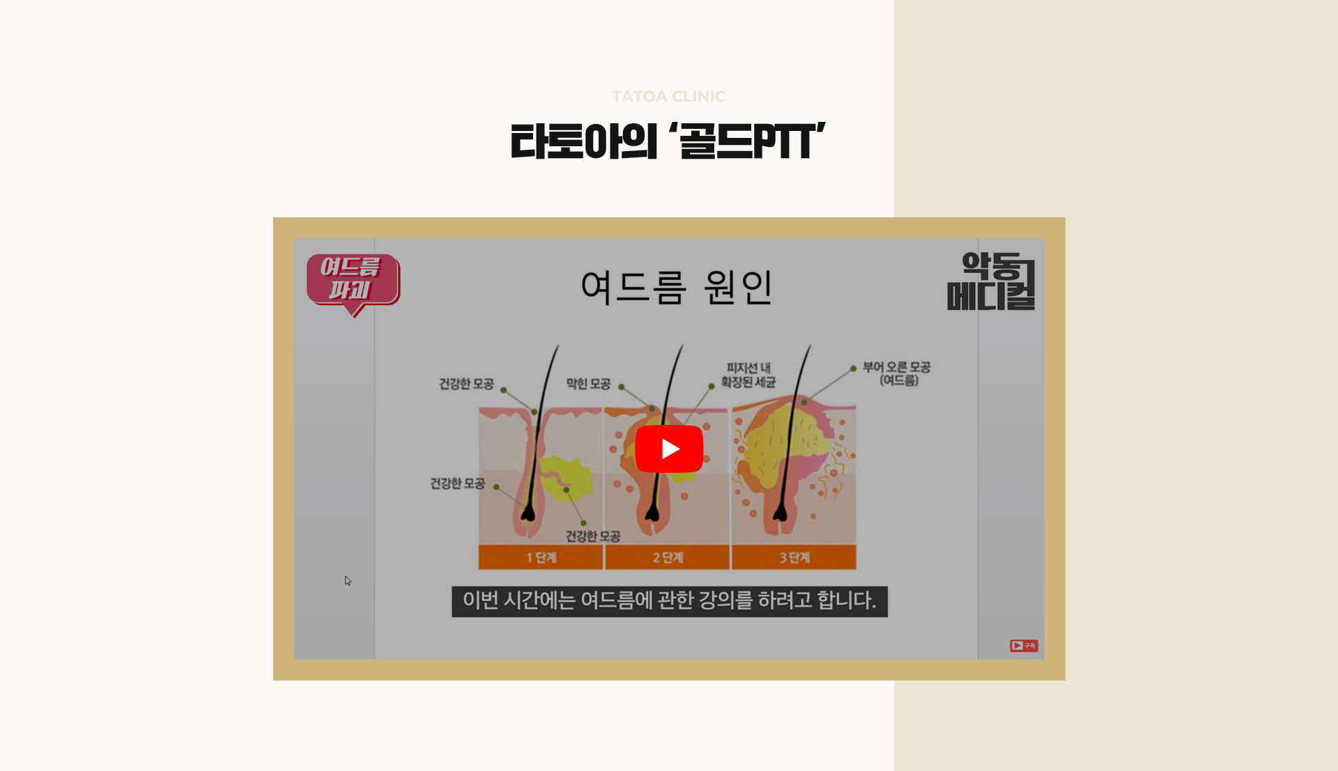 골드ptt